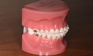 歯周病治療の流れ4-1